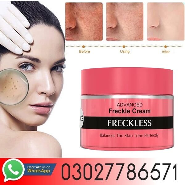 Advanced Freckle Cream In Pakistan